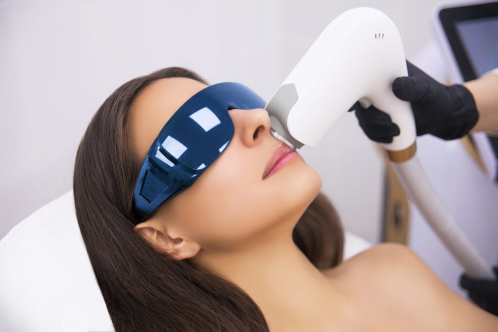 Laser hair removal treatment on upper lip area